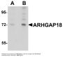 Anti-ARHGAP18 Antibody