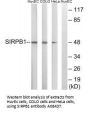 Anti-SIRPB1/Cd172B Antibody