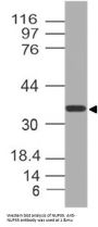 Anti-NUP35 Antibody