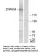 Anti-ZNF638/Np220 Antibody