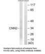 Anti-Calponin-2 CNN2 Antibody