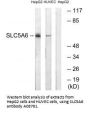Anti-SLC5A6/Smvt Antibody