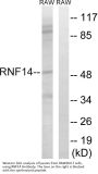 Anti-RNF14/Ara54 Antibody