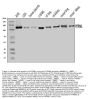 Anti-PITRM1 Antibody Picoband®