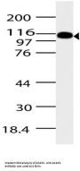 Anti-ASAP2/Pag3 Antibody