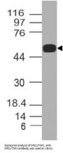 Anti-SPZ1/TSP1 Antibody