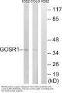 Anti-GOSR1/Gs28 Antibody