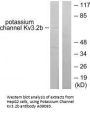 Anti-Potassium Channel Kv3.2b KCNC2 Antibody