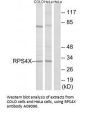 Anti-RPS4X Antibody