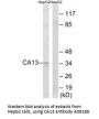 Anti-CA13/Ca Xiii Antibody