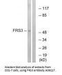Anti-FRS3 Antibody