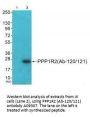 Anti-PPP1R2 (Ab-120/121) Antibody