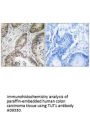 Anti-TUT1/Tutase Antibody