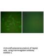 Anti-Mammaglobin SCGB2A2 Antibody