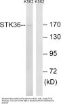 Anti-STK36 Antibody