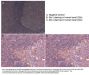 Anti-Sts-1 UBASH3B Antibody
