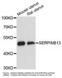 Anti-Serpin B13 SERPINB13 Antibody