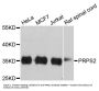 Anti-PRPS2 Antibody