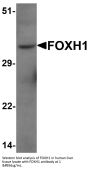 Anti-Forkhead box protein H1 FOXH1 Antibody