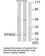 Anti-EFNA2/Ephrin A2 Antibody