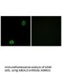 Anti-ABCA13 Antibody
