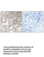 Anti-NCAPG2/Cap G2 Antibody