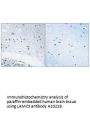 Anti-LAMC3/Laminin Gamma 3 Antibody