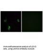 Anti-LAMC3/Laminin Gamma 3 Antibody