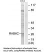 Anti-Ras-related protein Rab-6C RAB6C Antibody