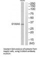 Anti-Protein S100-A5 S100A5 Antibody