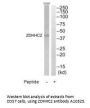 Anti-Palmitoyltransferase ZDHHC2 ZDHHC2 Antibody