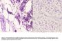 Anti-TG1019 (R251) OXER1 Antibody