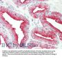 Anti-TMBIM1/Recs1 Antibody
