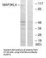 Anti-MAP3KL4 MAP3K21 Antibody