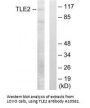 Anti-TLE2 Antibody