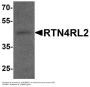 Anti-Reticulon-4 receptor-like 2 RTN4RL2 Antibody