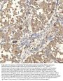 Anti-Mitochondrial dicarboxylate carrier/SLC25A10 Antibody Picoband®