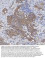 Anti-Mitochondrial dicarboxylate carrier/SLC25A10 Antibody Picoband®