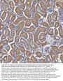 Anti-Mitochondrial dicarboxylate carrier/SLC25A10 Antibody Picoband®
