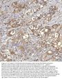 Anti-Mitochondrial dicarboxylate carrier/SLC25A10 Antibody Picoband®