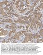 Anti-Mitochondrial dicarboxylate carrier/SLC25A10 Antibody Picoband®