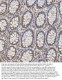 Anti-Mitochondrial dicarboxylate carrier/SLC25A10 Antibody Picoband®