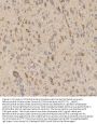 Anti-Mitochondrial dicarboxylate carrier/SLC25A10 Antibody Picoband®