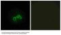 Anti-BLCAP Antibody