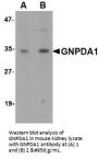 Anti-GNPDA1 Antibody