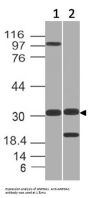 Anti-GNPDA1 Antibody