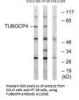 Anti-TUBGCP4/Gcp4 Antibody