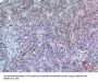 Anti-LIR-7 LILRA2 Antibody