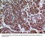 Anti-LIR-7 LILRA2 Antibody