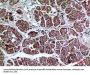 Anti-LIR-7 LILRA2 Antibody